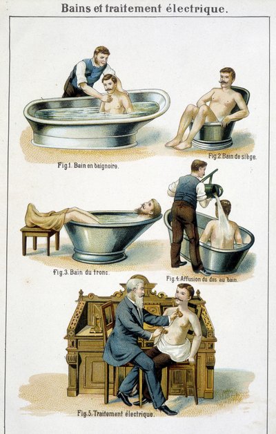 Bains et traitement électrique : 1) Baignoire, 2) Bain de siège, 3) Bain de tronc, 4) Bain de dos, 5) Traitement électrique - dans « Bilz, Médication naturelle », fin du 19e siècle - Unknown artist