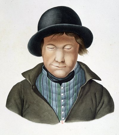 Lépreux d