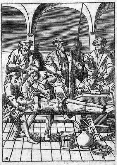 Torture au Moyen Âge : la question de l