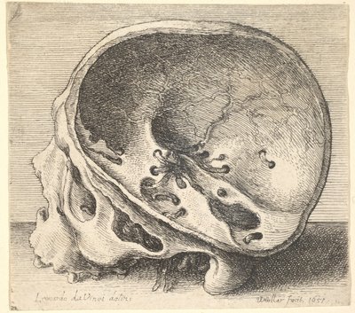 Crâne sectionné en profil à gauche avec le côté gauche du crâne enlevé, 1651 - Wenceslaus Hollar