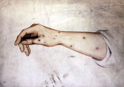 Étude d