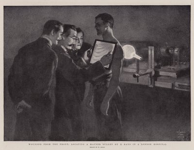 Blessés du front, localisation d