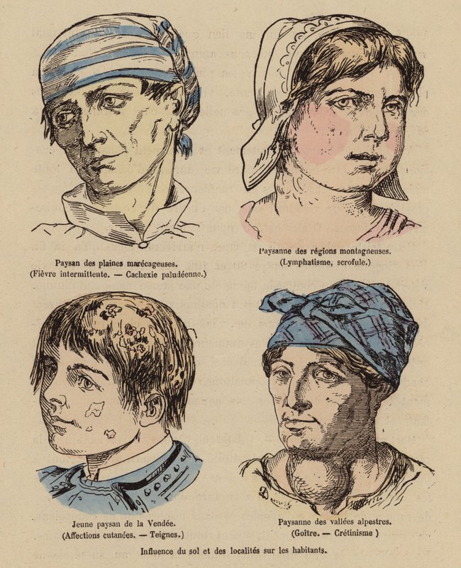 Influence du soleil et de la localisation géographique sur les gens - (after) French School