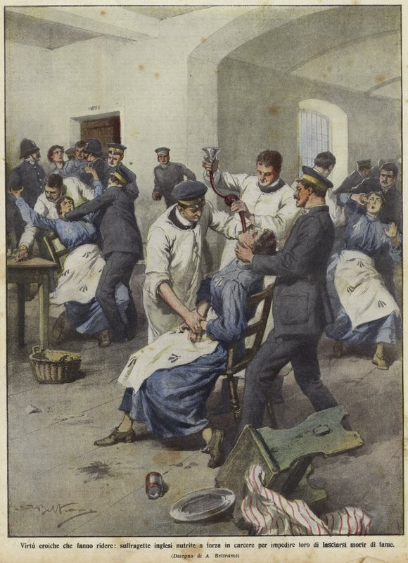 Les suffragettes britanniques nourries de force en prison - Achille Beltrame