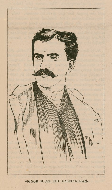 Portrait de Signor Giovanni Succi - English School