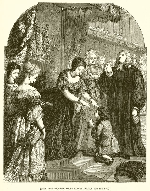 La reine Anne touchant le jeune Samuel Johnson pour le mal - English School
