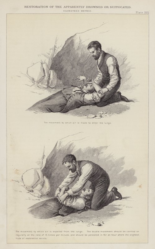 Restauration des noyés ou asphyxiés apparents - English School