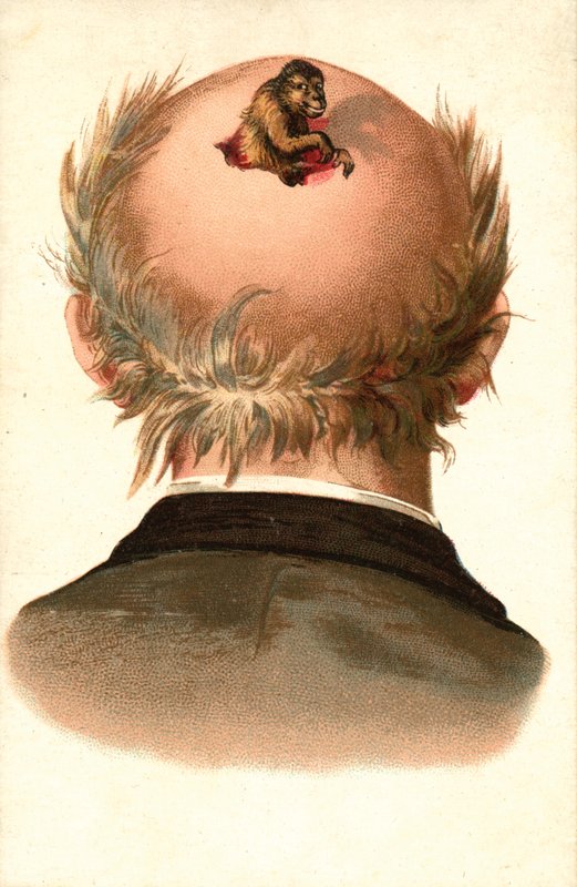 Tête d