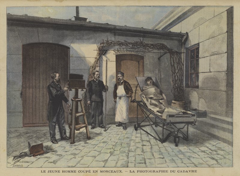 Un jeune homme découpé en morceaux - Fortune Louis Meaulle