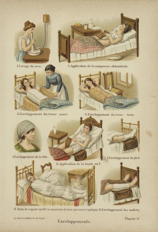 Bandages, enveloppements et compresses - German School