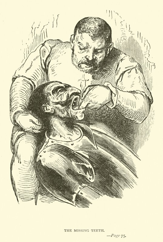 Les dents manquantes - John Gilbert