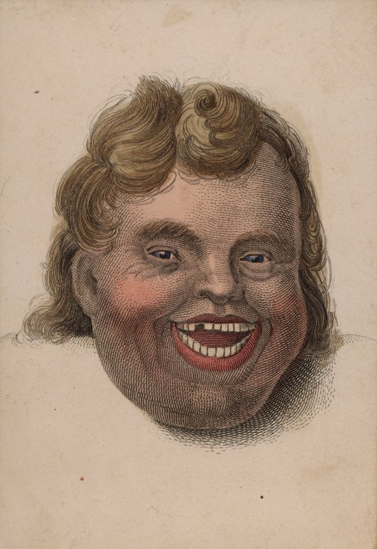 Visage d