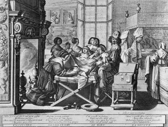 Série de gravures (eau-forte) intitulée « Le Mariage à la Ville » de 1633 par Abraham Bosse - « Accouchement » : sur le lit de travail