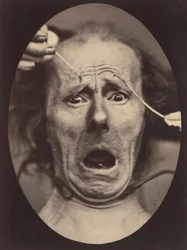Électro-Physiologie, Figure 64, 1854-56, imprimé en 1862