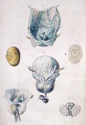 Maladies de la vessie et de la prostate, de 
