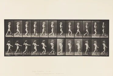 A, Jambes arquées; Garçon; B, Caries vertébrales; Fille marchant