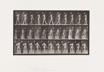 Planche 541. Sclérose Cérébro-Spinale Multiple (Choréique); Marche
