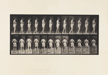 Planche 542. Sclérose cérébro-spinale multiple - Marche