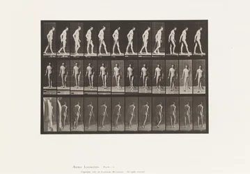 Planche 559. Sclérose en plaques; Marchant avec une canne