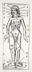 Un corps qui a été sous le scalpel, avec des veines étiquetées
