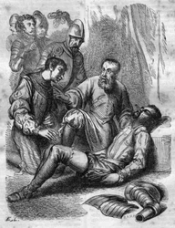 Ambroise Paré, chirurgien français