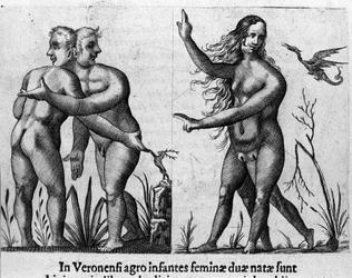 Différents types de monstres humains : un homme avec deux corps et têtes et une femme avec quatre jambes et deux sexes. Gravure de « De monstrorum natura, causis et differentiis » de Fortunio Liceti (1577-1656), scientifique italien. 1646