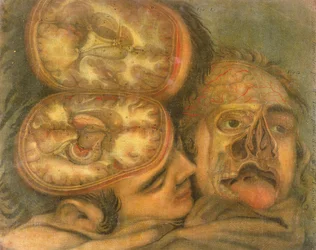 Coupe transversale du cerveau, 1746