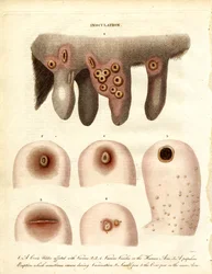 Inoculation et progression de la maladie