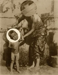 Tache de naissance (Salomé)