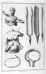 Chirurgie mammaire, 1751-1777