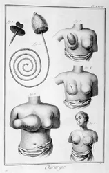 Chirurgie mammaire