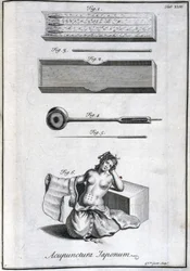 Médecine alternative : planche représentant les aiguilles d