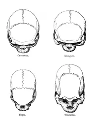 La configuration verticale du crâne, 1848