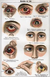 Maladies de l