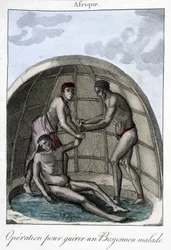 Opération pour soigner un Bojesmen - gravure