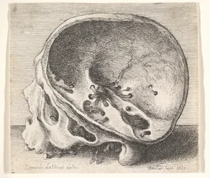 Crâne sectionné en profil à gauche avec le côté gauche du crâne enlevé, 1651