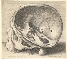 Crâne sectionné en profil à gauche avec le côté gauche du crâne enlevé, 1651