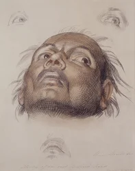Étude de la tête d