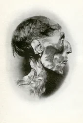 Tête de la momie de Ramsès II, pharaon égyptien de la 19e dynastie, vers 1212 av. J.-C.